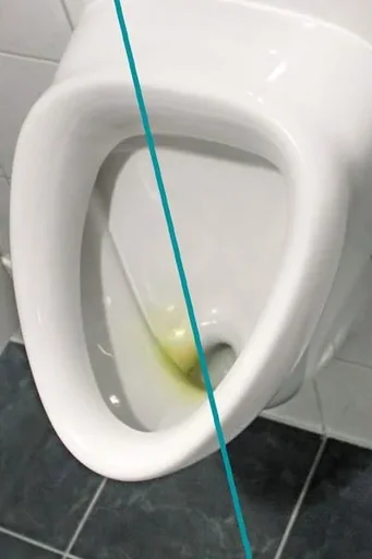 "WC Hai, 500 ml - Urinsteinlöser Konzentrat - image"